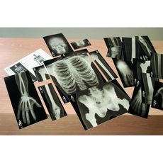 Human Skeleton True To Life